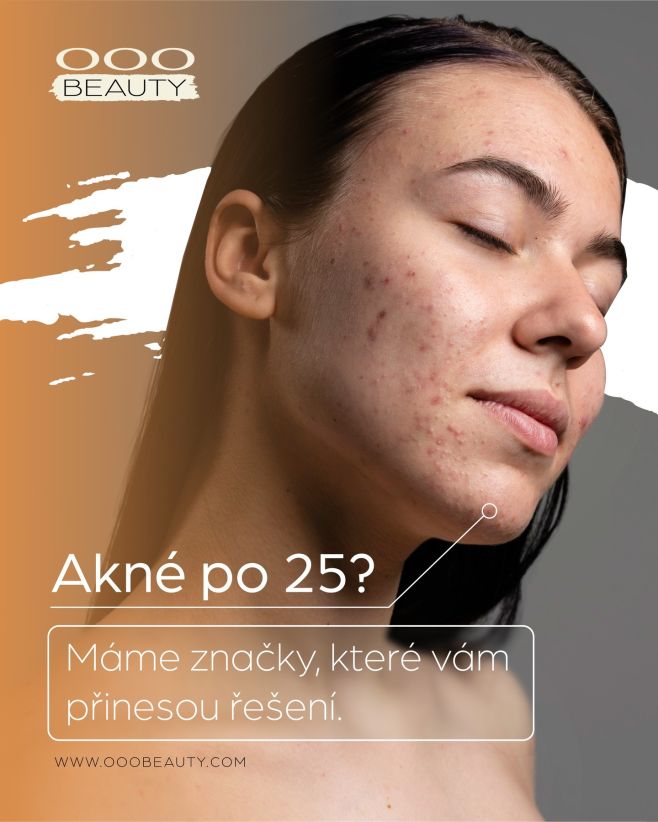 "Myslela jsem, že akné skončí s pubertou..." 😩 - Každá z nás Dobré zprávy: Máme značky, které to vyřeší: * Clear Skin foam...